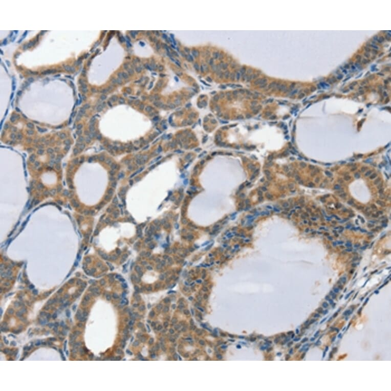 Immunohistochemistry - SCD Antibody from Signalway Antibody (37896) - Antibodies.com