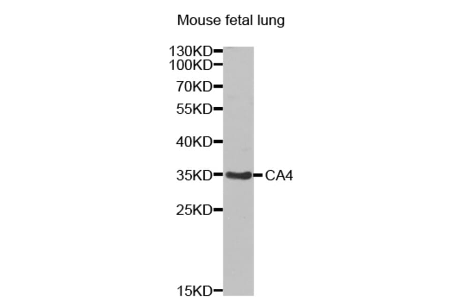 Western blot - CA4 antibody from Signalway Antibody (38437) - Antibodies.com
