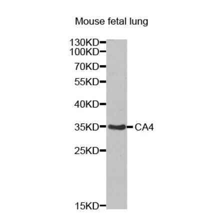 Western blot - CA4 antibody from Signalway Antibody (38437) - Antibodies.com