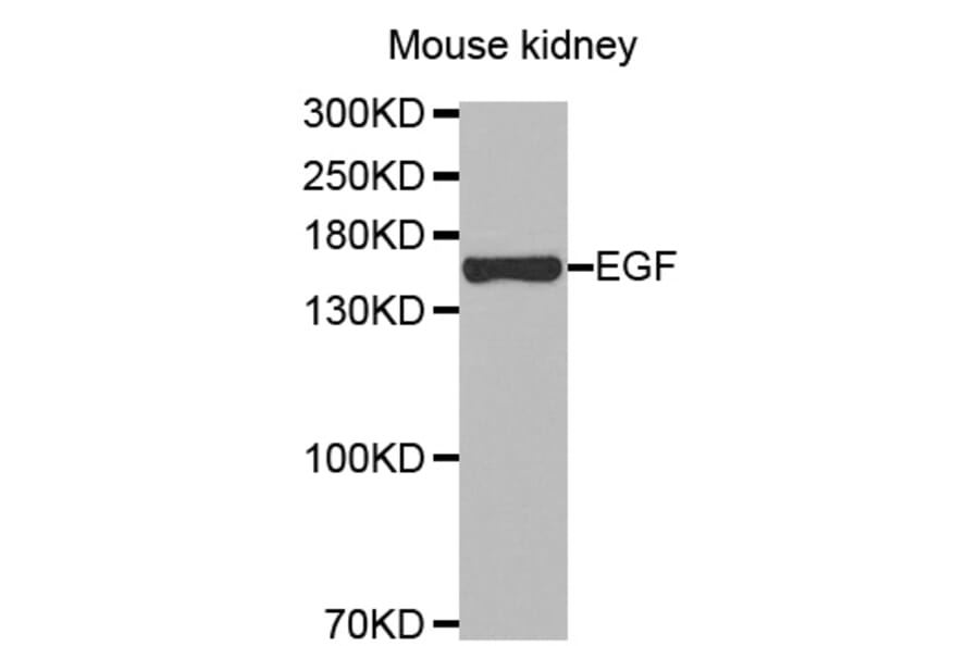 Western blot - EGF antibody from Signalway Antibody (38447) - Antibodies.com