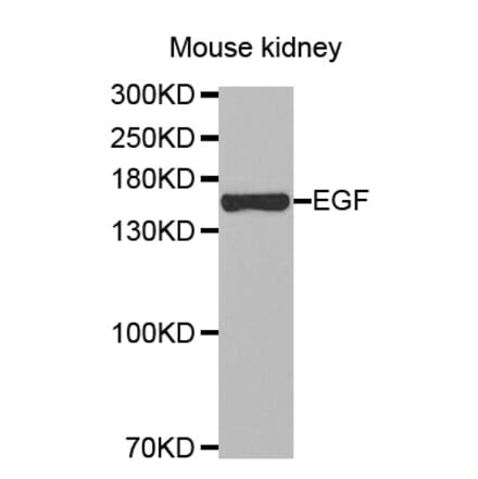 Western blot - EGF antibody from Signalway Antibody (38447) - Antibodies.com