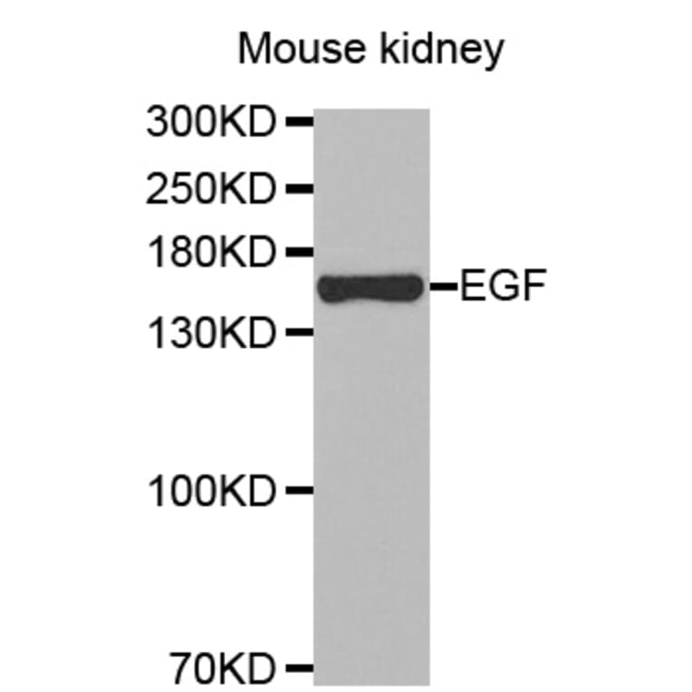 Western blot - EGF antibody from Signalway Antibody (38447) - Antibodies.com