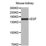 Western blot - EGF antibody from Signalway Antibody (38447) - Antibodies.com