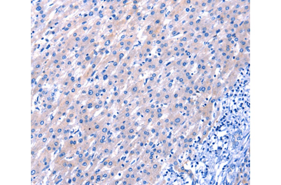 Immunohistochemistry - EGF antibody from Signalway Antibody (38447) - Antibodies.com
