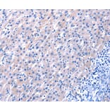 Immunohistochemistry - EGF antibody from Signalway Antibody (38447) - Antibodies.com