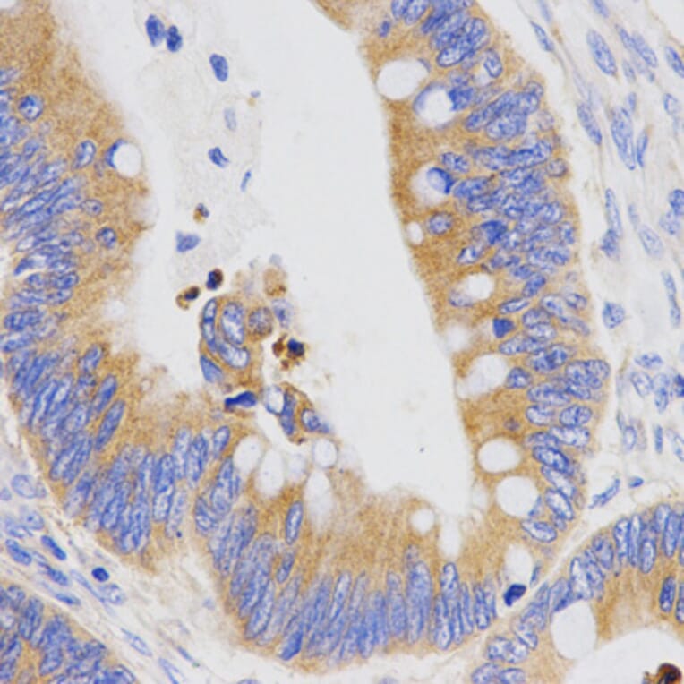 Immunohistochemistry - PGC antibody from Signalway Antibody (38465) - Antibodies.com