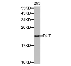 Western blot - DUT antibody from Signalway Antibody (38489) - Antibodies.com