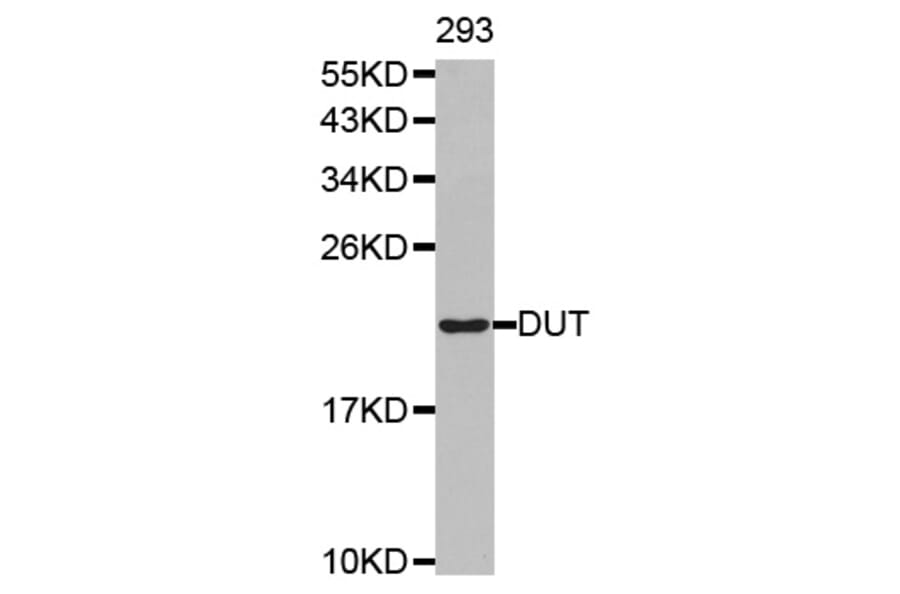 Western blot - DUT antibody from Signalway Antibody (38489) - Antibodies.com