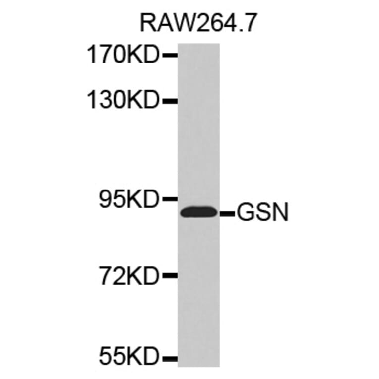 Western blot - GSN antibody from Signalway Antibody (38506) - Antibodies.com