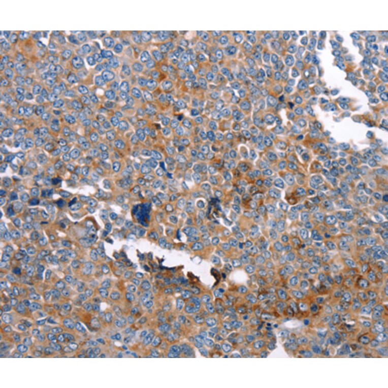 Immunohistochemistry - GSN antibody from Signalway Antibody (38506) - Antibodies.com