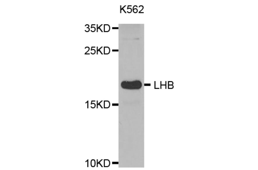 Western blot - LHB antibody from Signalway Antibody (38531) - Antibodies.com