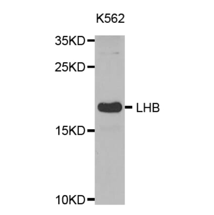 Western blot - LHB antibody from Signalway Antibody (38531) - Antibodies.com