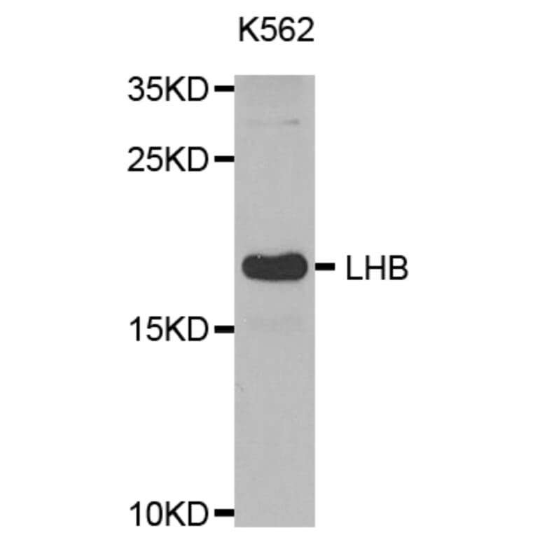 Western blot - LHB antibody from Signalway Antibody (38531) - Antibodies.com