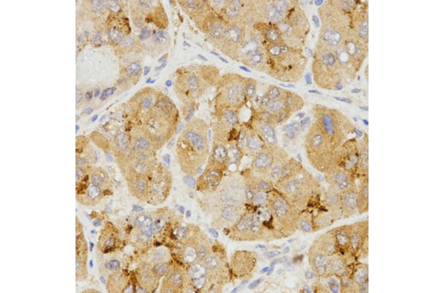 Immunohistochemistry - LHB antibody from Signalway Antibody (38531) - Antibodies.com
