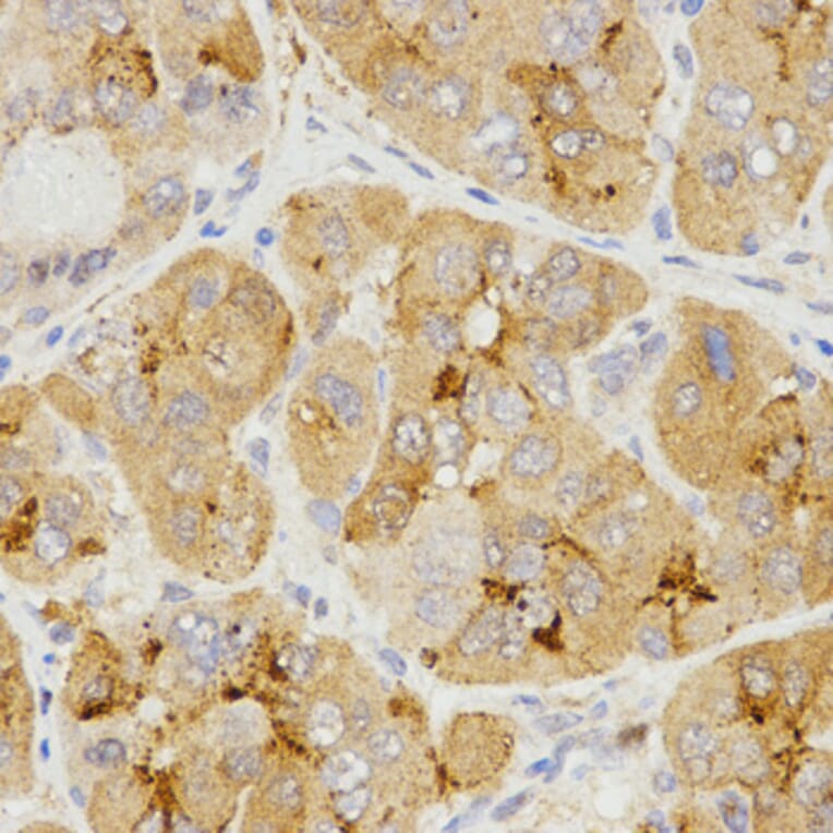 Immunohistochemistry - LHB antibody from Signalway Antibody (38531) - Antibodies.com