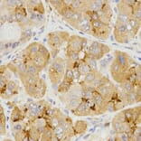 Immunohistochemistry - LHB antibody from Signalway Antibody (38531) - Antibodies.com