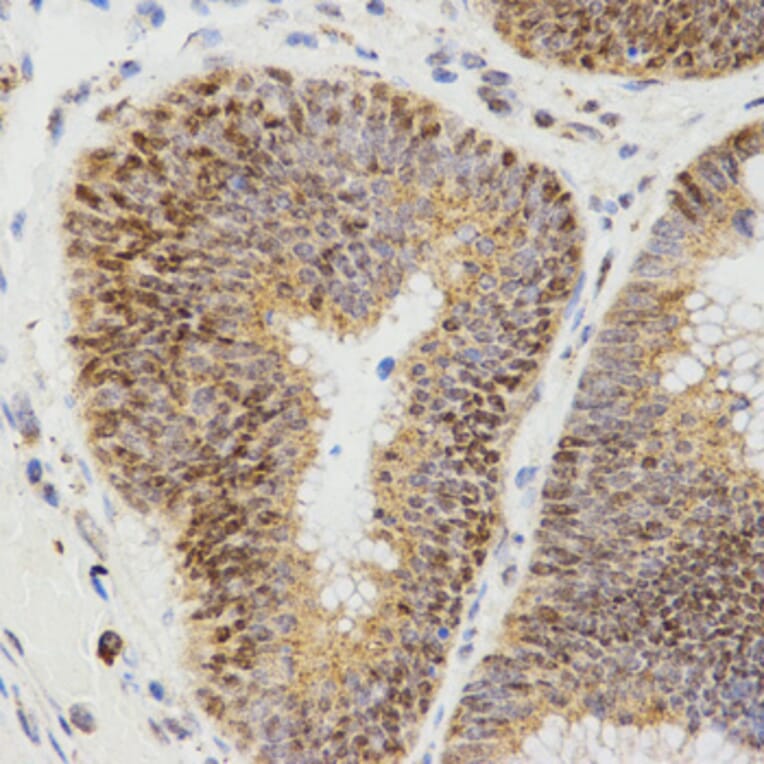 Immunohistochemistry - LHB antibody from Signalway Antibody (38531) - Antibodies.com