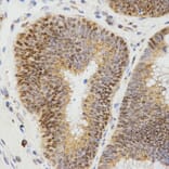 Immunohistochemistry - LHB antibody from Signalway Antibody (38531) - Antibodies.com