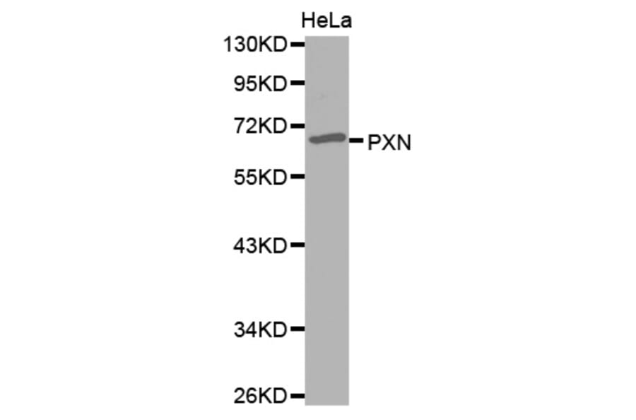 Western blot - PXN antibody from Signalway Antibody (38560) - Antibodies.com