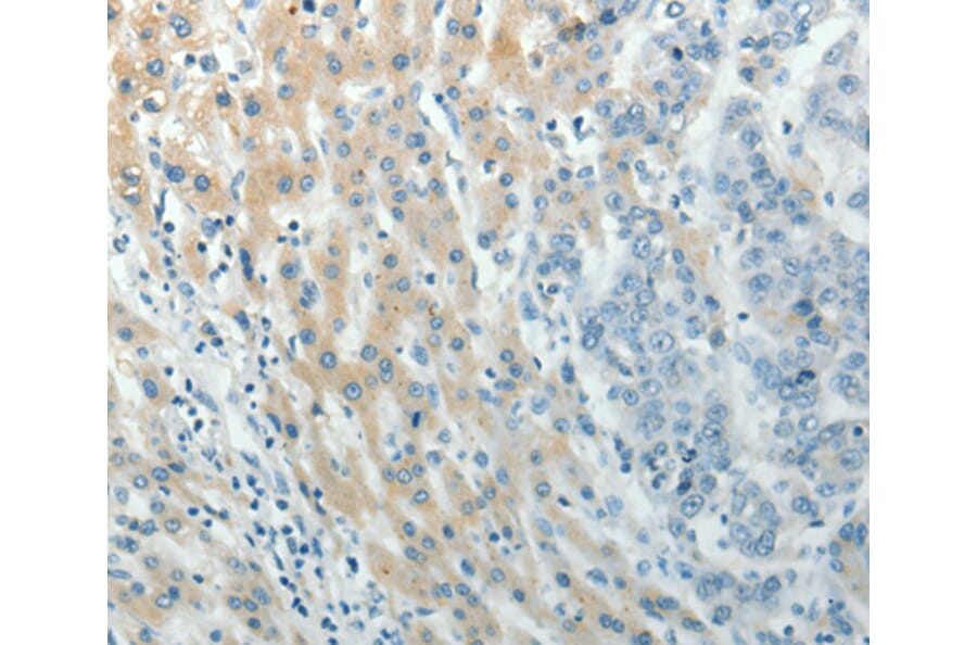 Immunohistochemistry - PXN antibody from Signalway Antibody (38560) - Antibodies.com