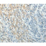 Immunohistochemistry - PXN antibody from Signalway Antibody (38560) - Antibodies.com