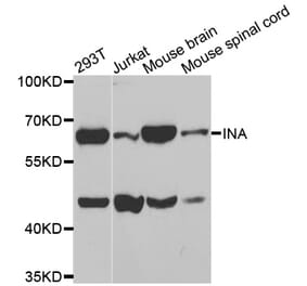 Western blot - INA antibody from Signalway Antibody (38584) - Antibodies.com
