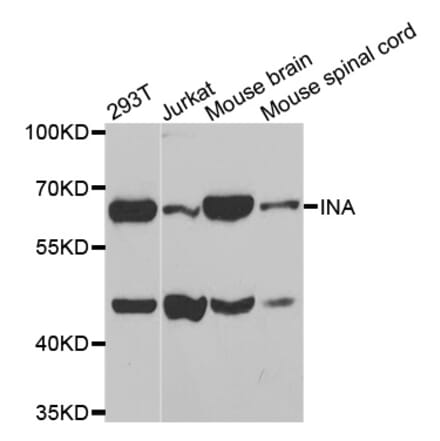 Western blot - INA antibody from Signalway Antibody (38584) - Antibodies.com