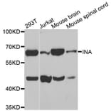 Western blot - INA antibody from Signalway Antibody (38584) - Antibodies.com
