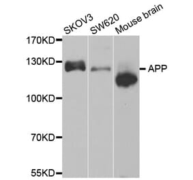 Western blot - APP antibody from Signalway Antibody (38604) - Antibodies.com