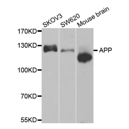 Western blot - APP antibody from Signalway Antibody (38604) - Antibodies.com