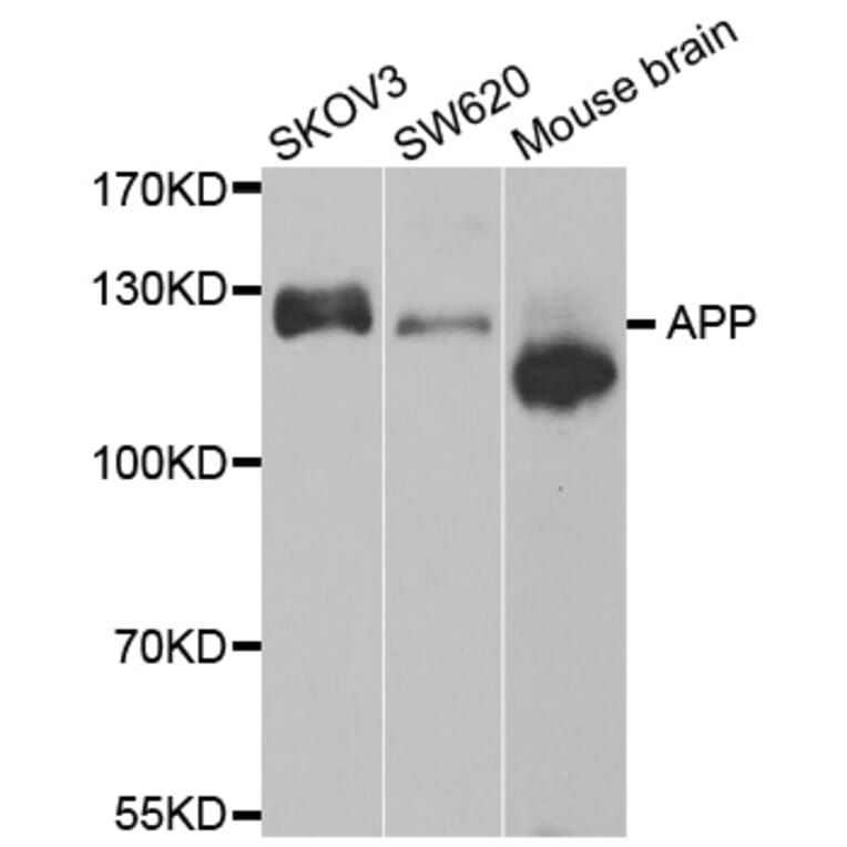 Western blot - APP antibody from Signalway Antibody (38604) - Antibodies.com