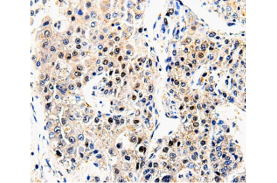 Immunohistochemistry - APP antibody from Signalway Antibody (38604) - Antibodies.com