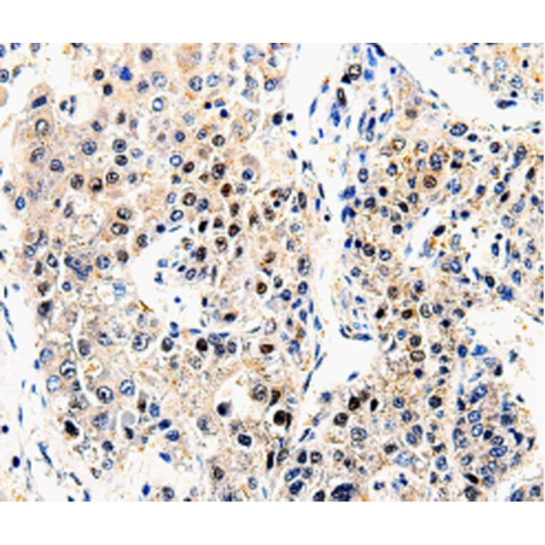 Immunohistochemistry - APP antibody from Signalway Antibody (38604) - Antibodies.com