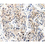 Immunohistochemistry - APP antibody from Signalway Antibody (38604) - Antibodies.com