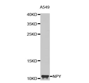 Western blot - NPY antibody from Signalway Antibody (38619) - Antibodies.com