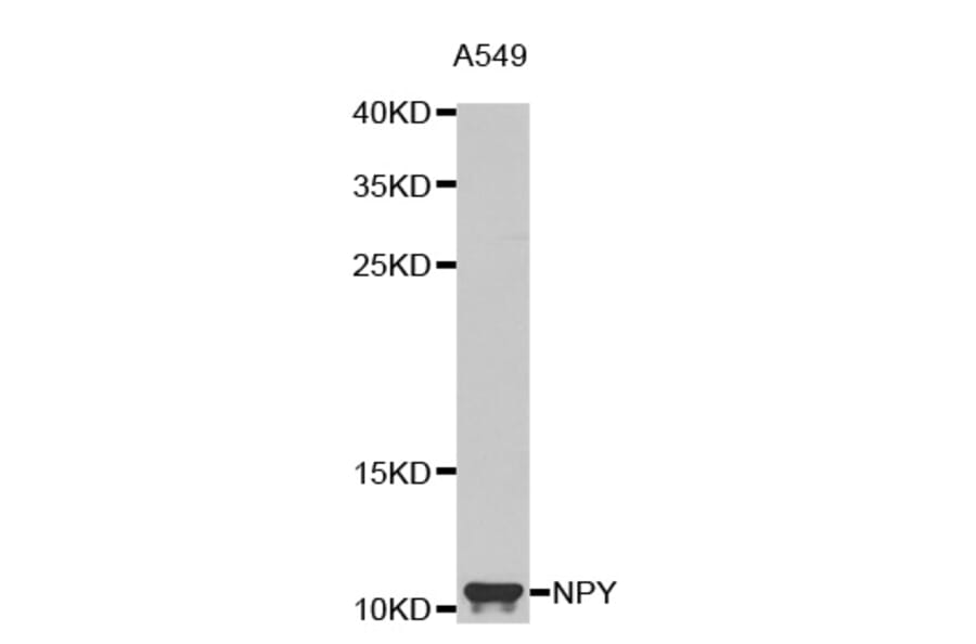 Western blot - NPY antibody from Signalway Antibody (38619) - Antibodies.com