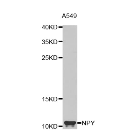 Western blot - NPY antibody from Signalway Antibody (38619) - Antibodies.com