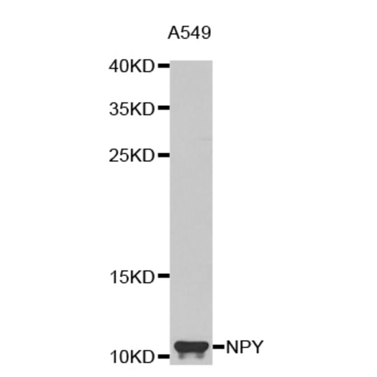 Western blot - NPY antibody from Signalway Antibody (38619) - Antibodies.com