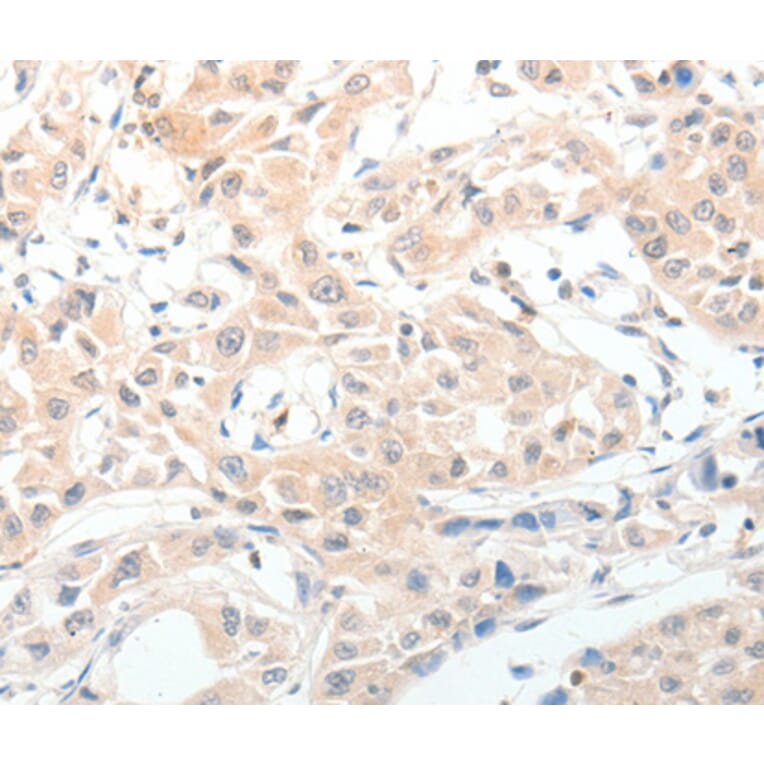 Immunohistochemistry - NPY antibody from Signalway Antibody (38619) - Antibodies.com