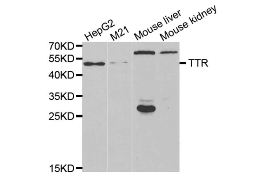 Western blot - TTR antibody from Signalway Antibody (38625) - Antibodies.com