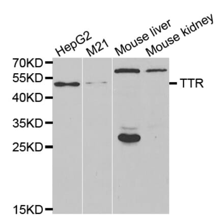 Western blot - TTR antibody from Signalway Antibody (38625) - Antibodies.com