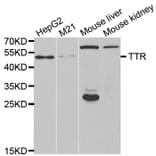 Western blot - TTR antibody from Signalway Antibody (38625) - Antibodies.com