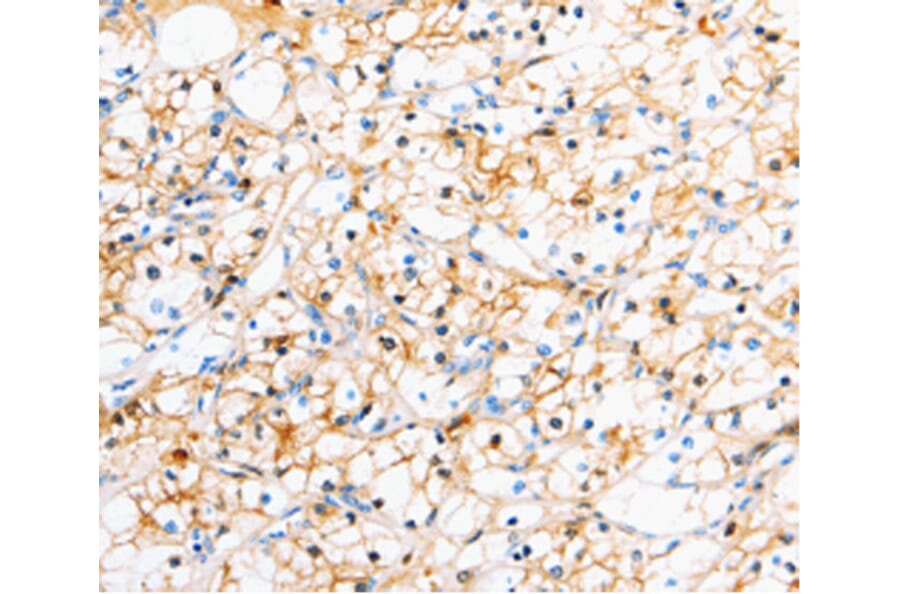 Immunohistochemistry - TTR antibody from Signalway Antibody (38625) - Antibodies.com