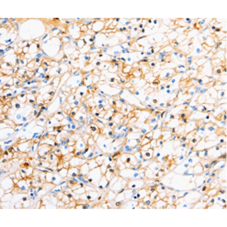 Immunohistochemistry - TTR antibody from Signalway Antibody (38625) - Antibodies.com