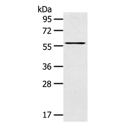 LPP Antibody from Signalway Antibody (40362) - Antibodies.com