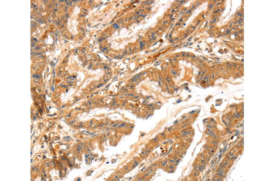 Immunohistochemistry - LPP Antibody from Signalway Antibody (40362) - Antibodies.com