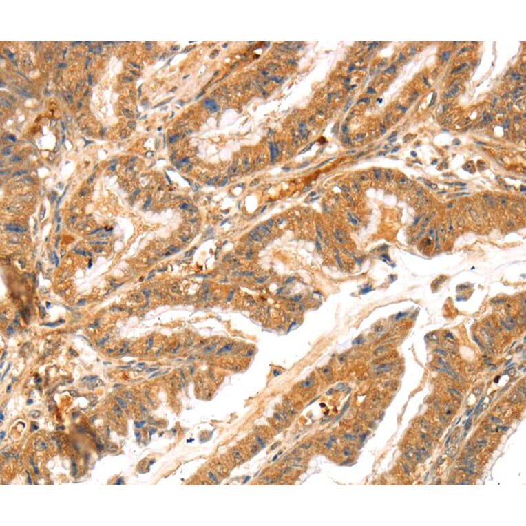 Immunohistochemistry - LPP Antibody from Signalway Antibody (40362) - Antibodies.com