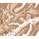 Immunohistochemistry - LPP Antibody from Signalway Antibody (40362) - Antibodies.com