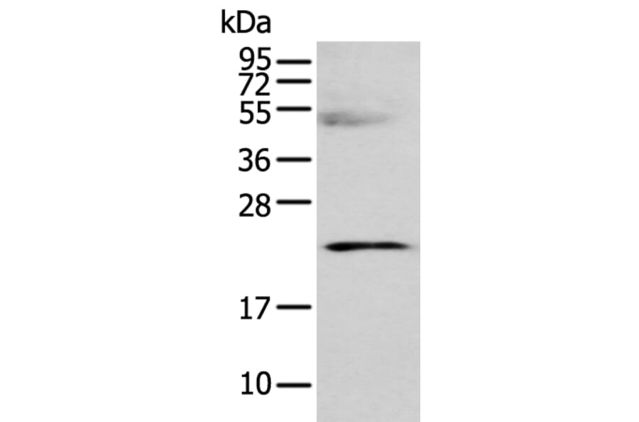 C8G Antibody from Signalway Antibody (42930) - Antibodies.com