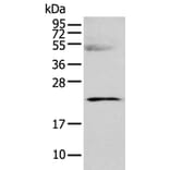 C8G Antibody from Signalway Antibody (42930) - Antibodies.com